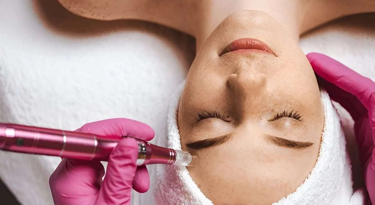Microneedling Full Face